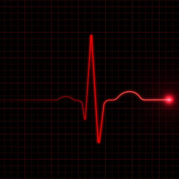Picture of Intersection Between Personal Injury and Probate in Wrongful Death and Survival Actions